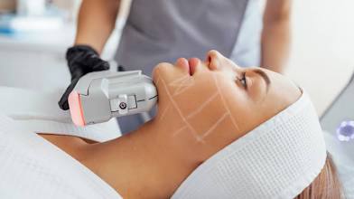 HIFU Skin Tightening Service