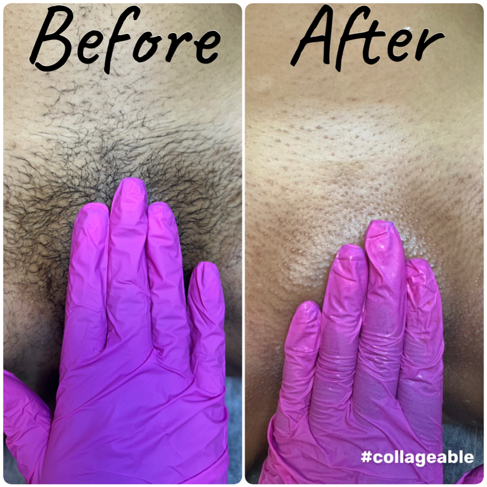 Brazilian Wax at Sacred Essence Aesthetics in Memphis, TN