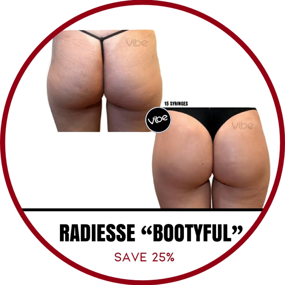 Radiesse “Bootyful” at Vibe Medispa & Skincare in Lakewood, CO