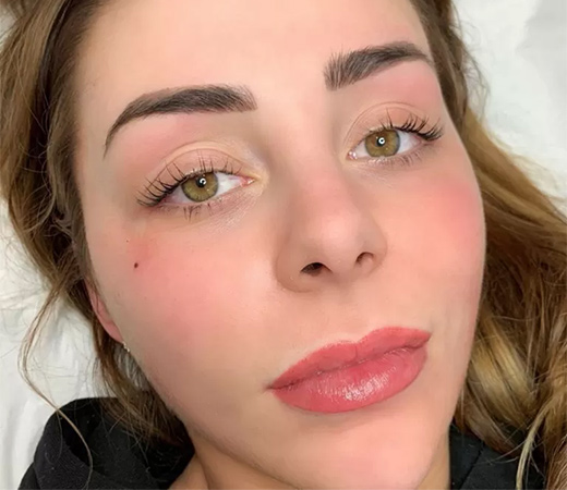 Freckles/Beauty Marks