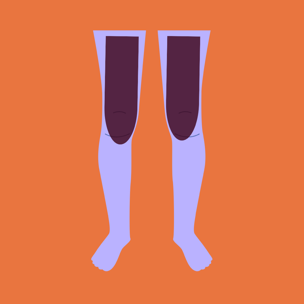upper leg