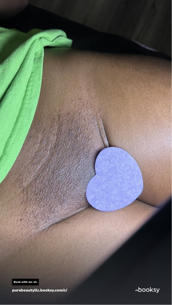 🩶Brazilian Wax