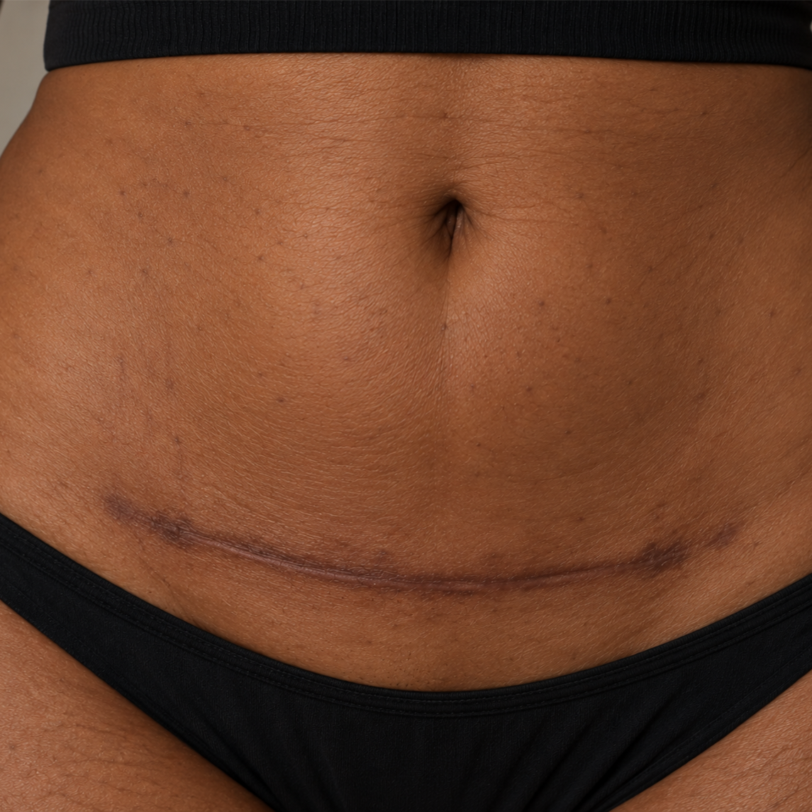 Dark Scar Neutralization at Sleek La Beautique in Greater Northdale, FL
