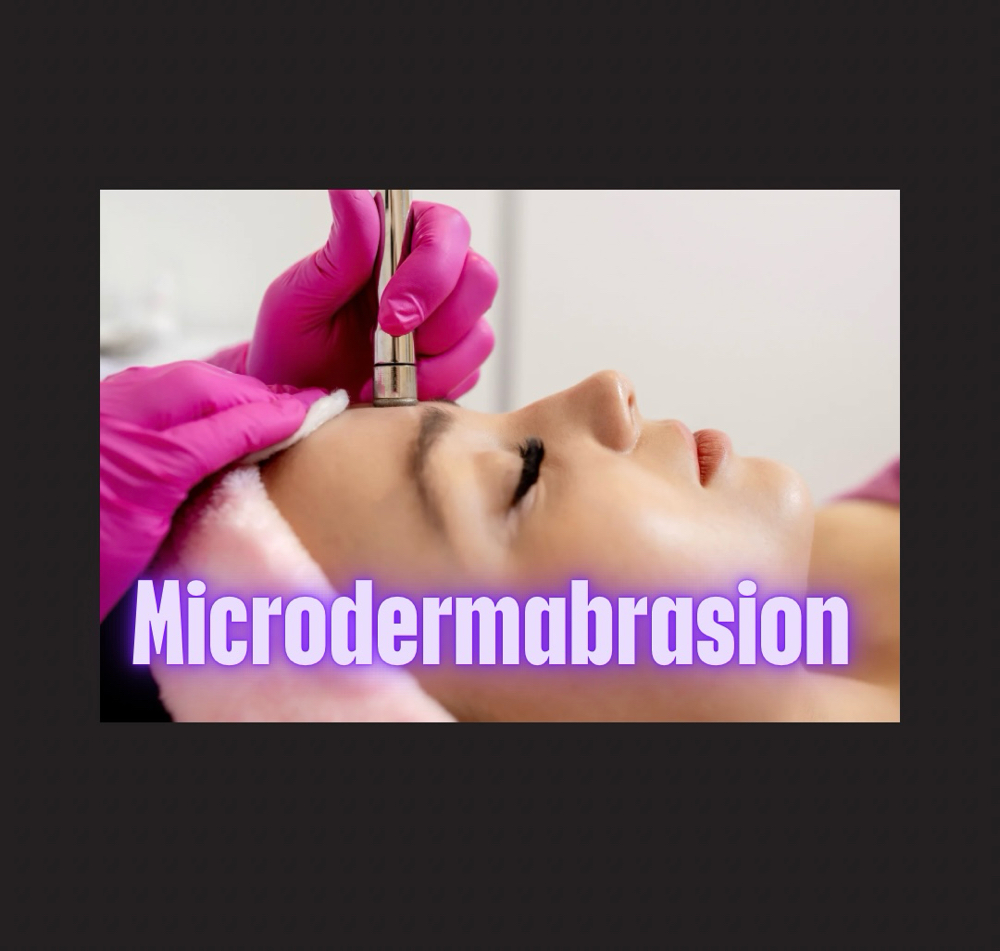 Microdermabrasion Facial