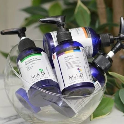 Chemical Peel (Acid peels)