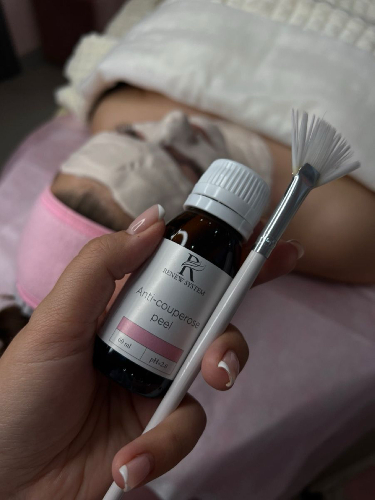 Professional Chemical Peel
