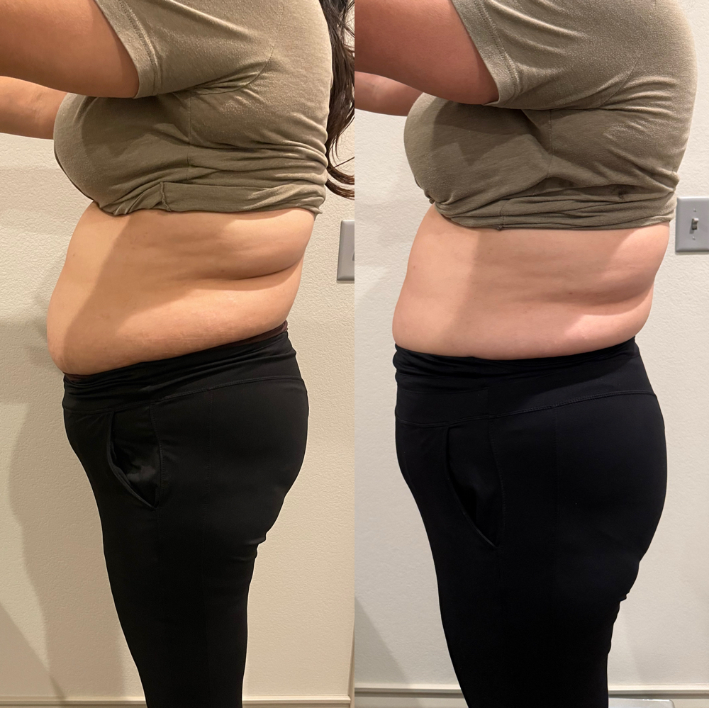 Refined Body Sculpt