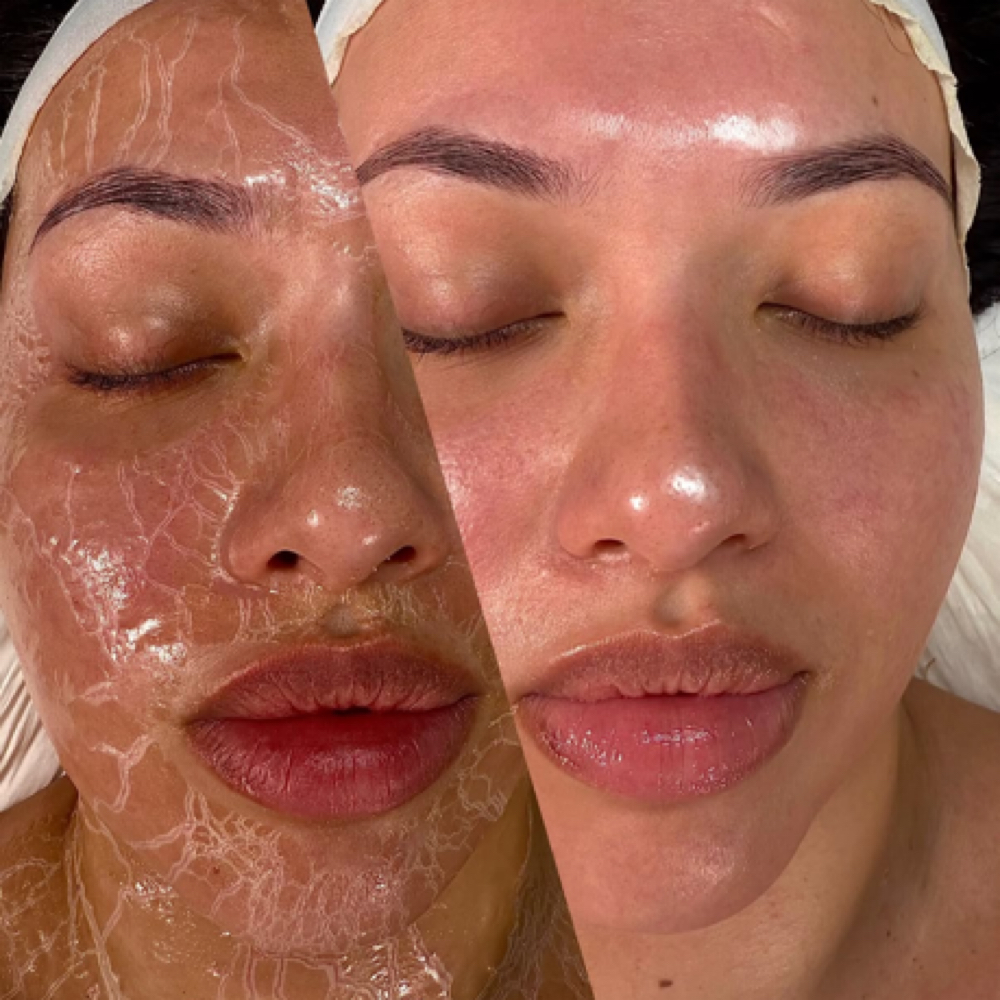 LIFT FACIAL ✨ at Gigi’s Beauté LLC in Lanham, MD