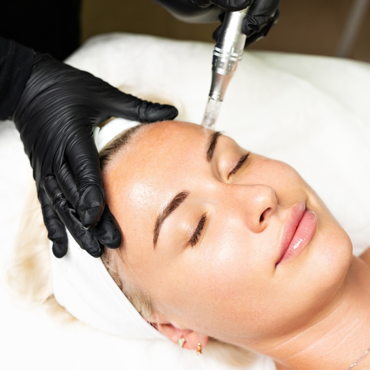 Microneedling at LusCH Botanical Skincare in Grants Pass, OR