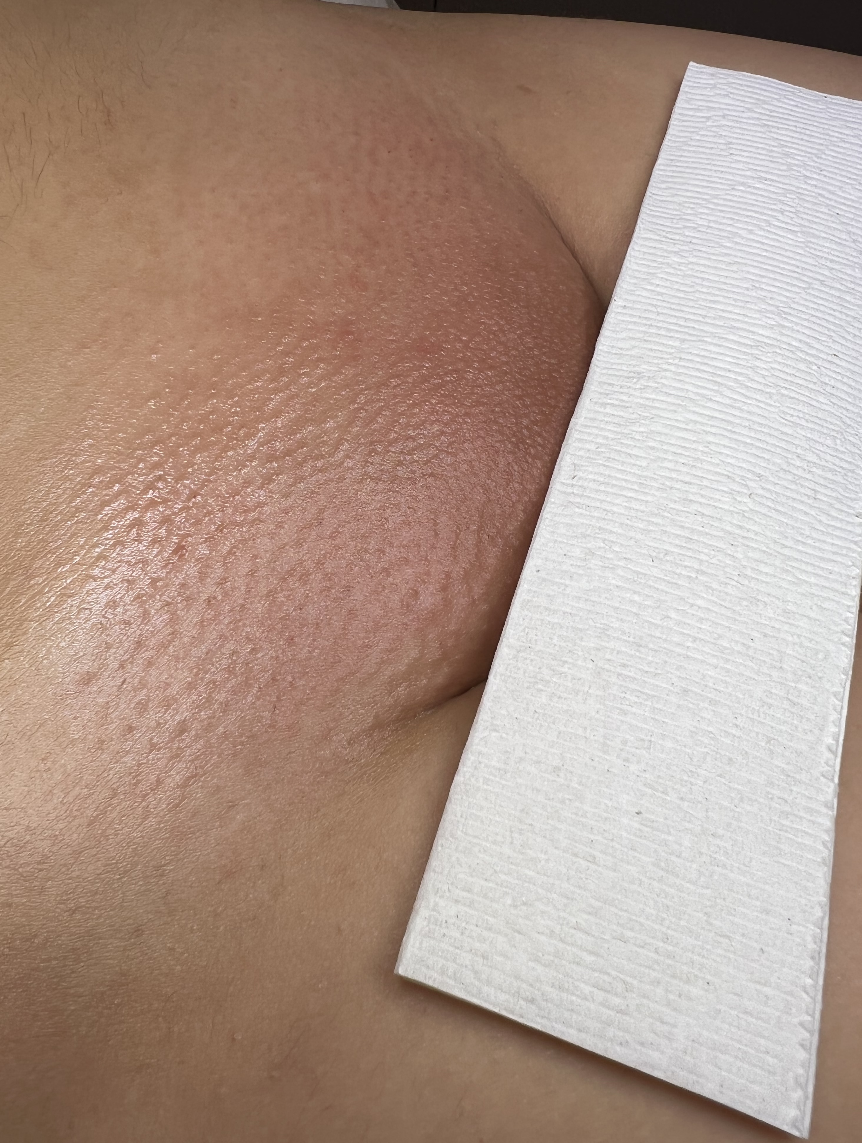 BIKINI FULL at Esthetically Steph in San Antonio, TX