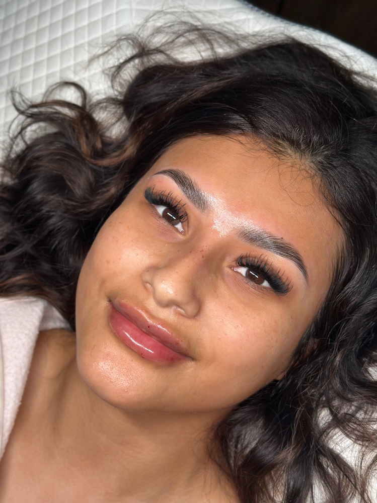 Hybrid 3 Week Fill at Alo Aesthetics in Wichita, KS