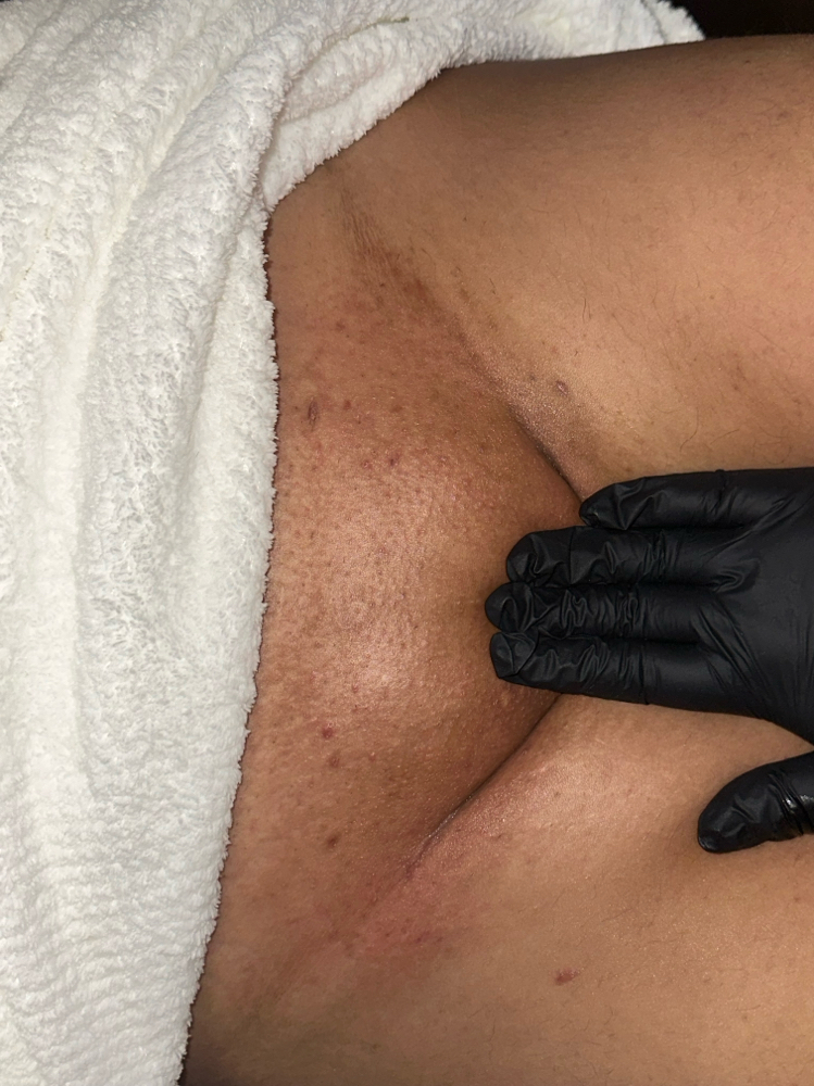 Brazilian Wax