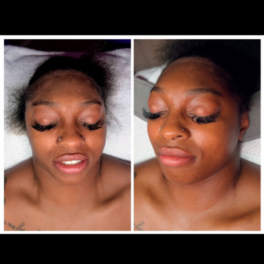 Hydration Recovery Facial at EstibyJos in Wauwatosa, WI