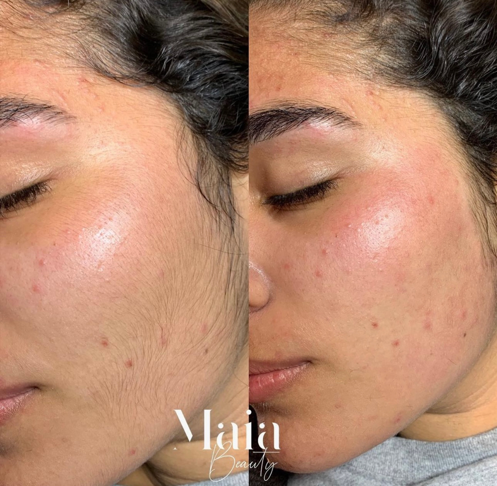Facial Threading/ Waxing