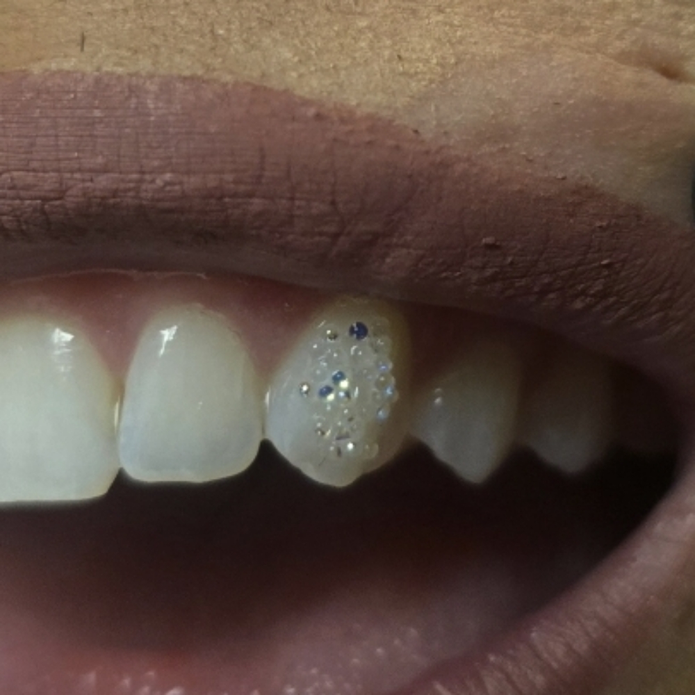 Diamond Dust Tooth Gems