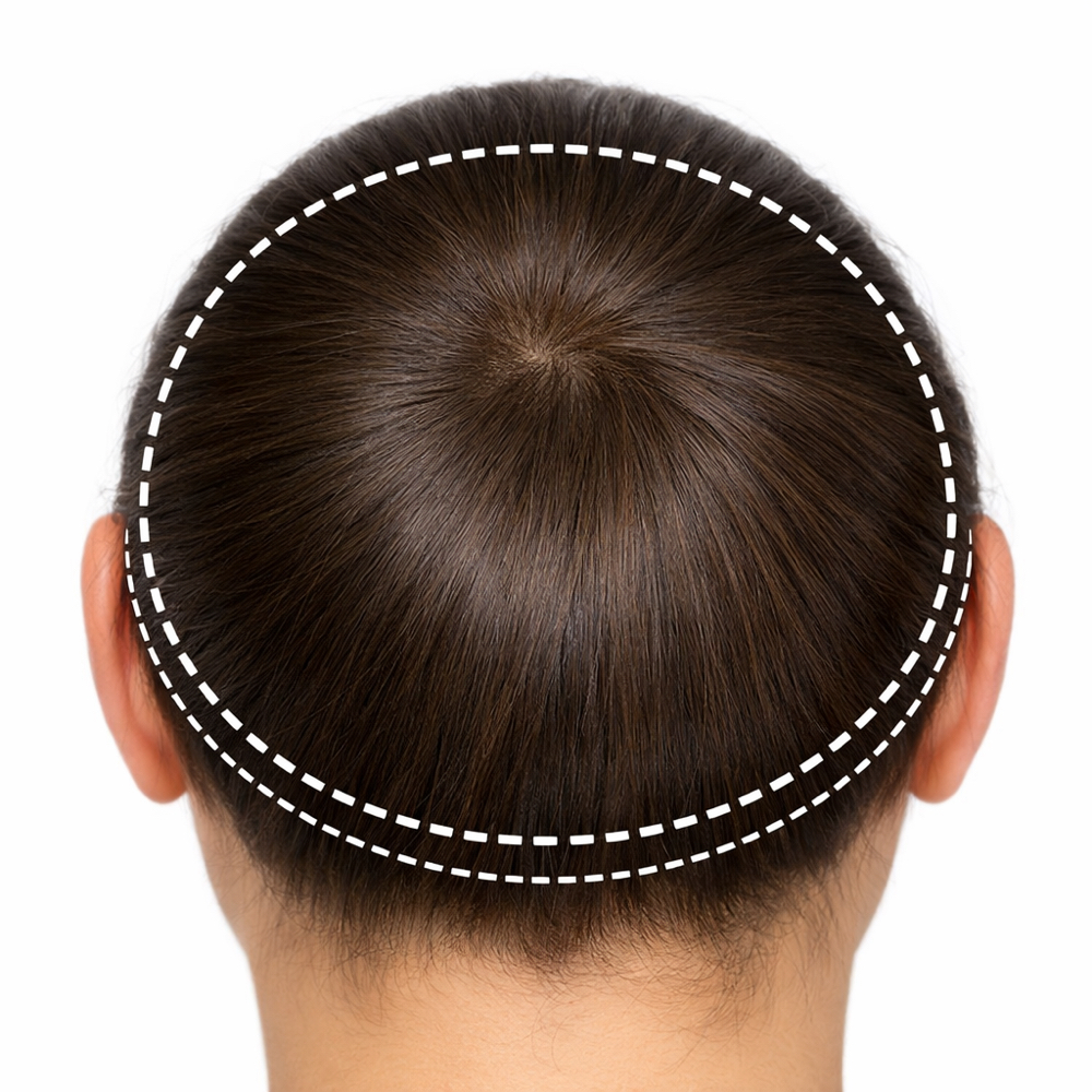 Only Hairline Brazilian Treatment at Bobbie Biondi Hair in Bellevue, WA