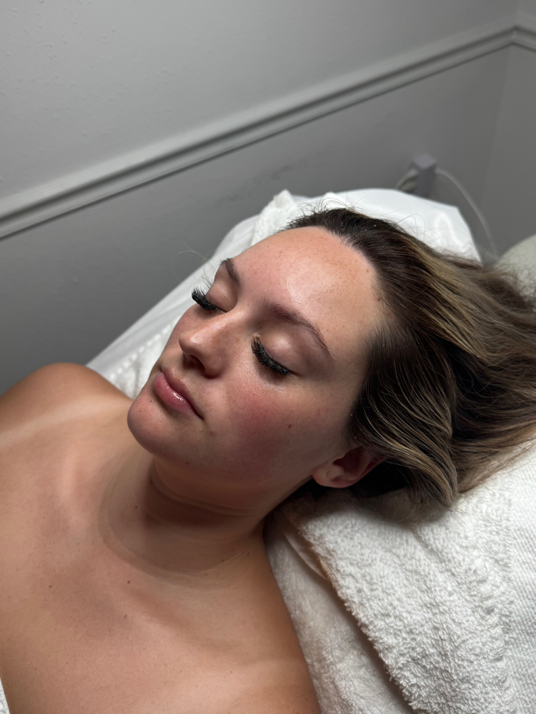 Microdermabrasion at Divinely You Beauty Bar in New Caney, TX