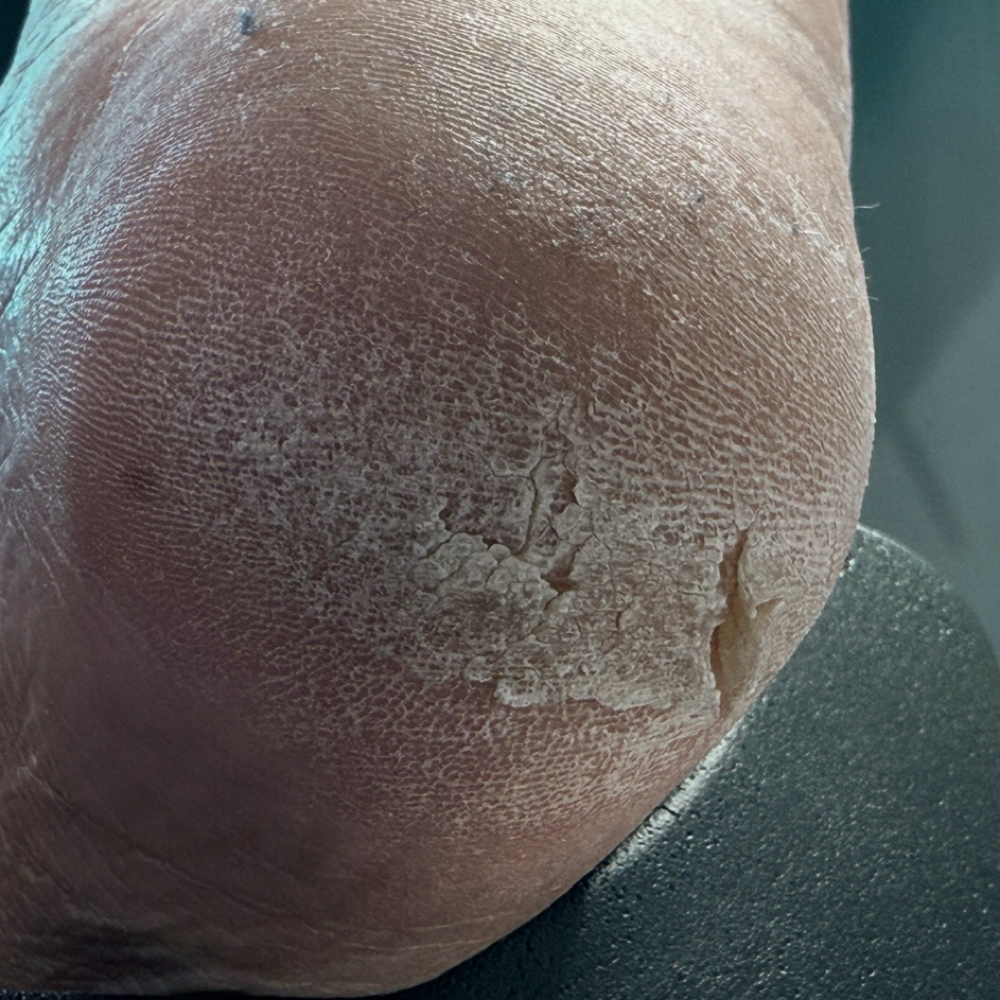 Paramedical Pedi (Existing Client) at Manicured By Nara in Johnston, RI