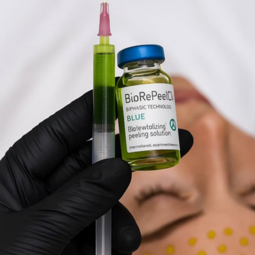 BIOREPEEL at Esther Esthetics in Suwanee, GA