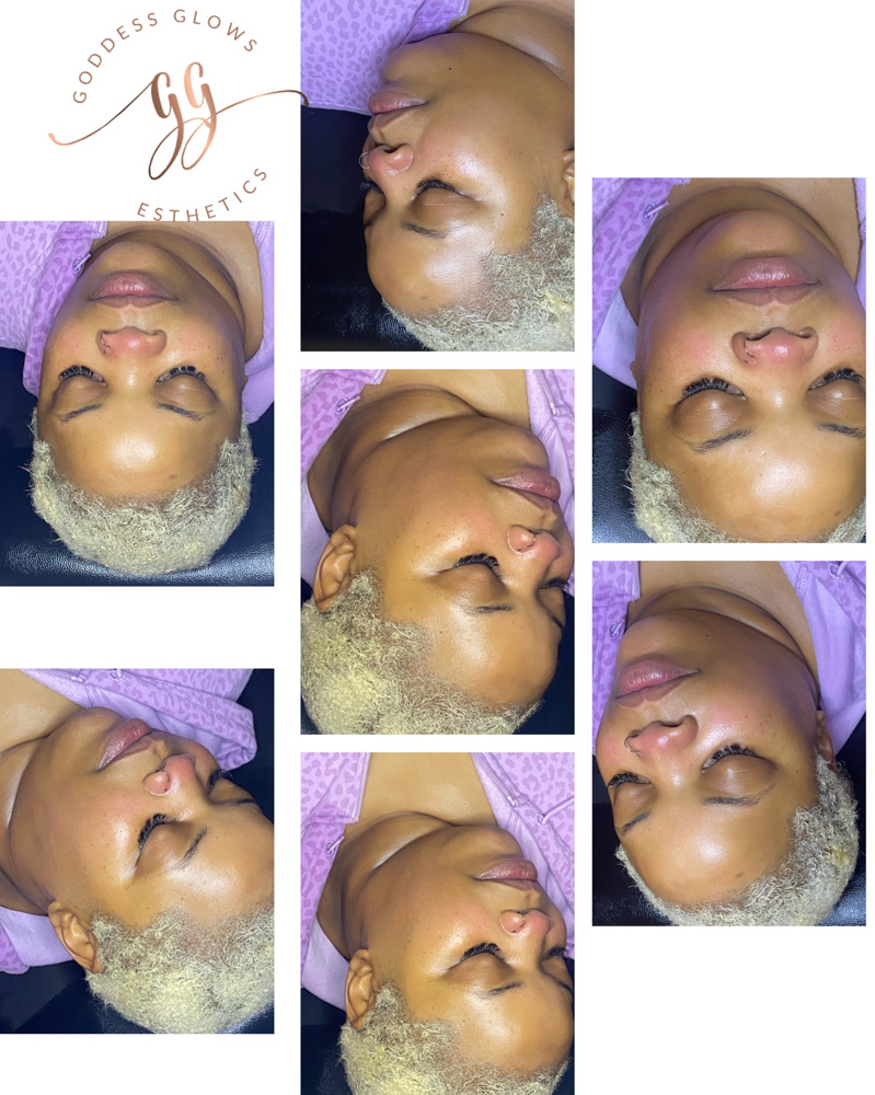Ray of Sunshine Facial