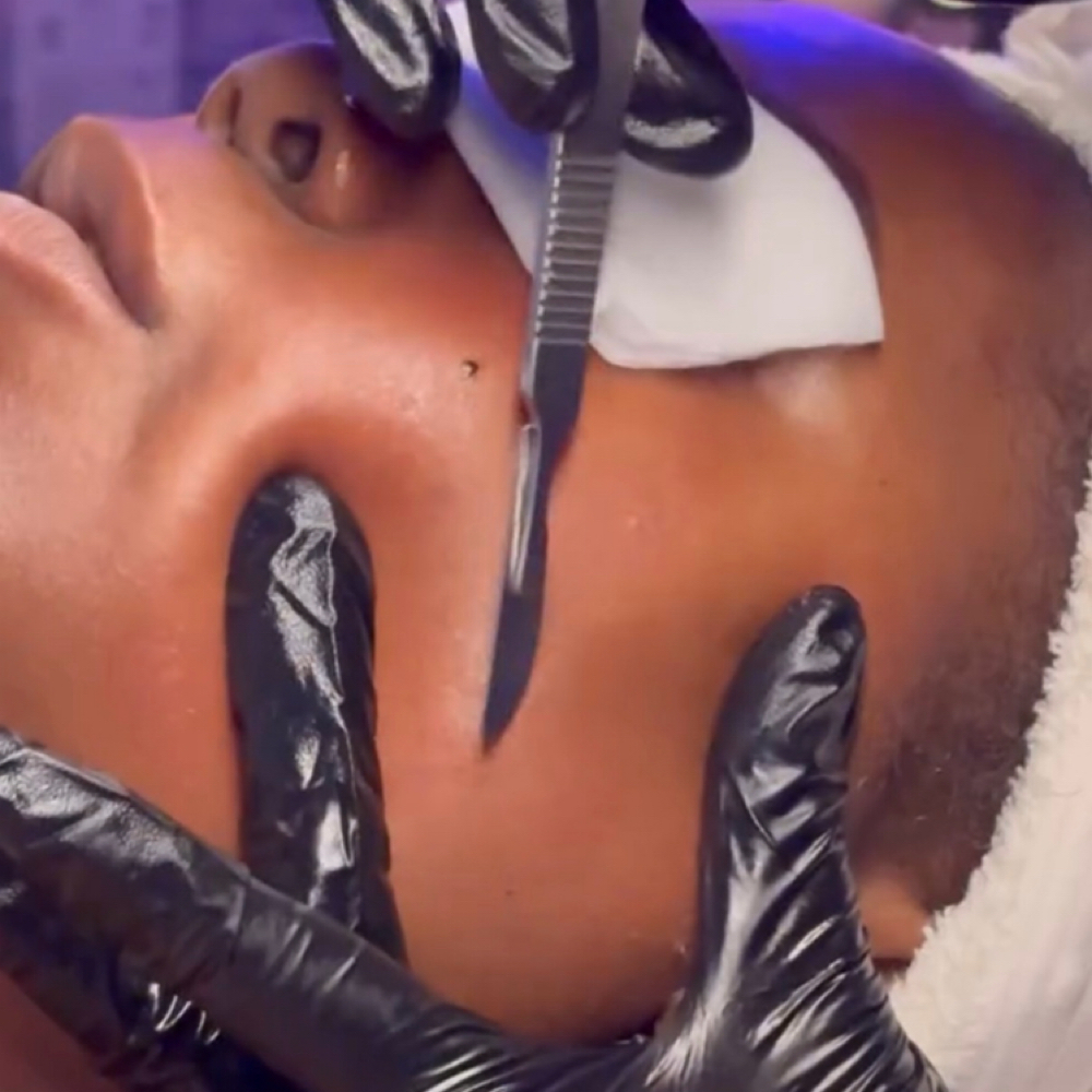 Dermaplane at Soul Skinful in North Miami, FL