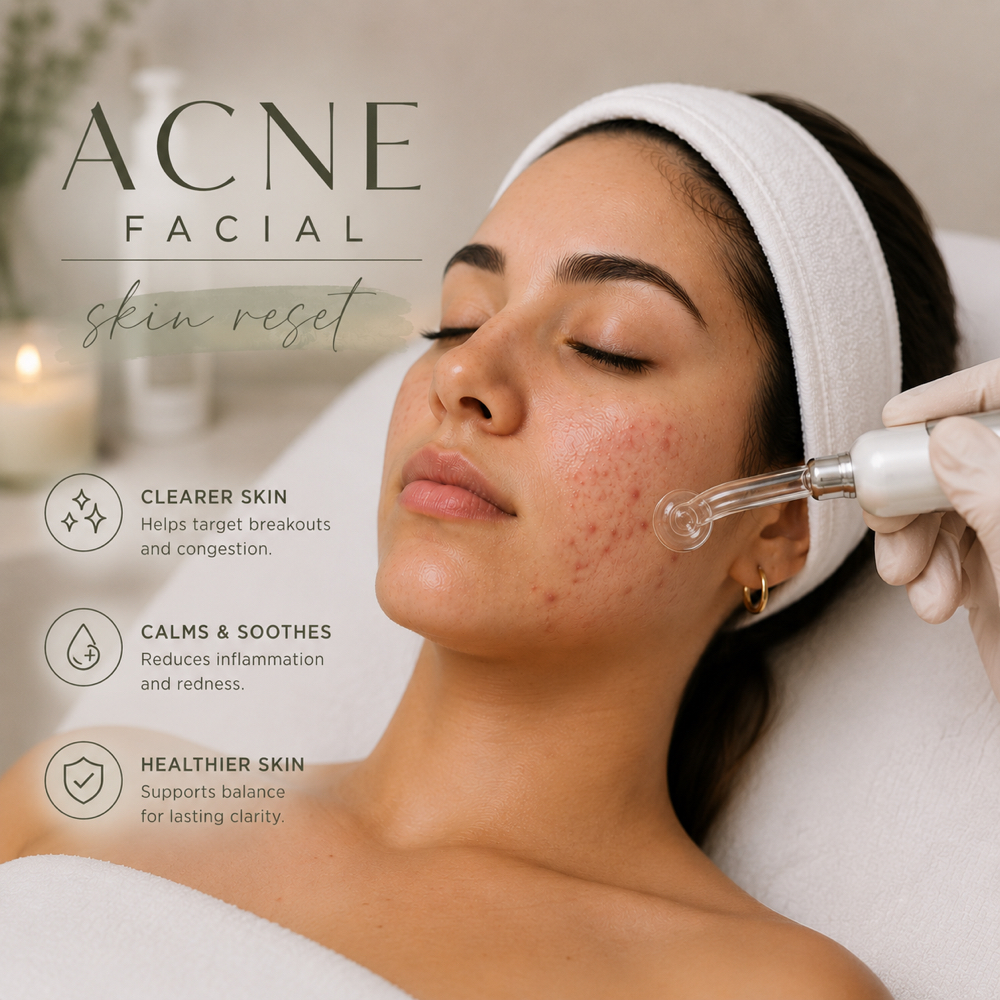 Acne Facial at Skinsationstudio in Ukiah, CA