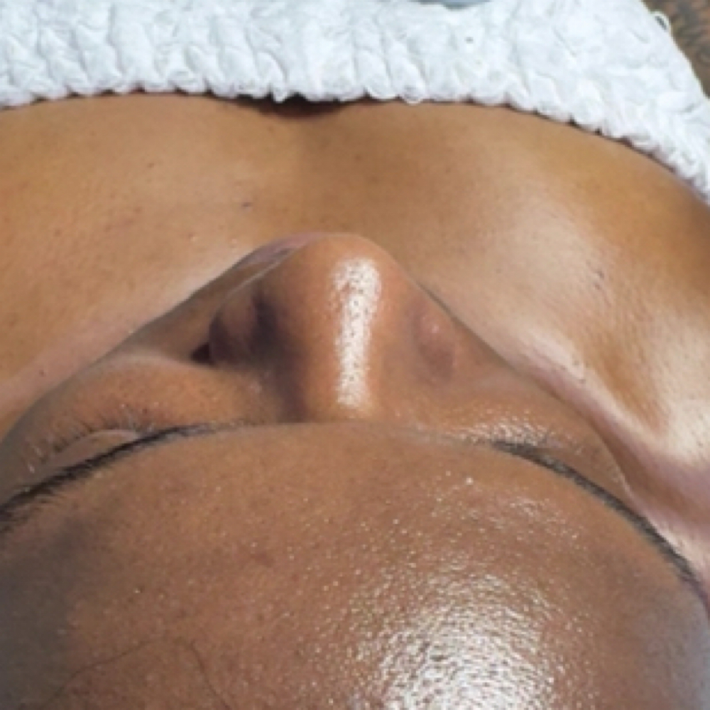 Signature Back facial at Marsha Threatt in Jonesboro, GA