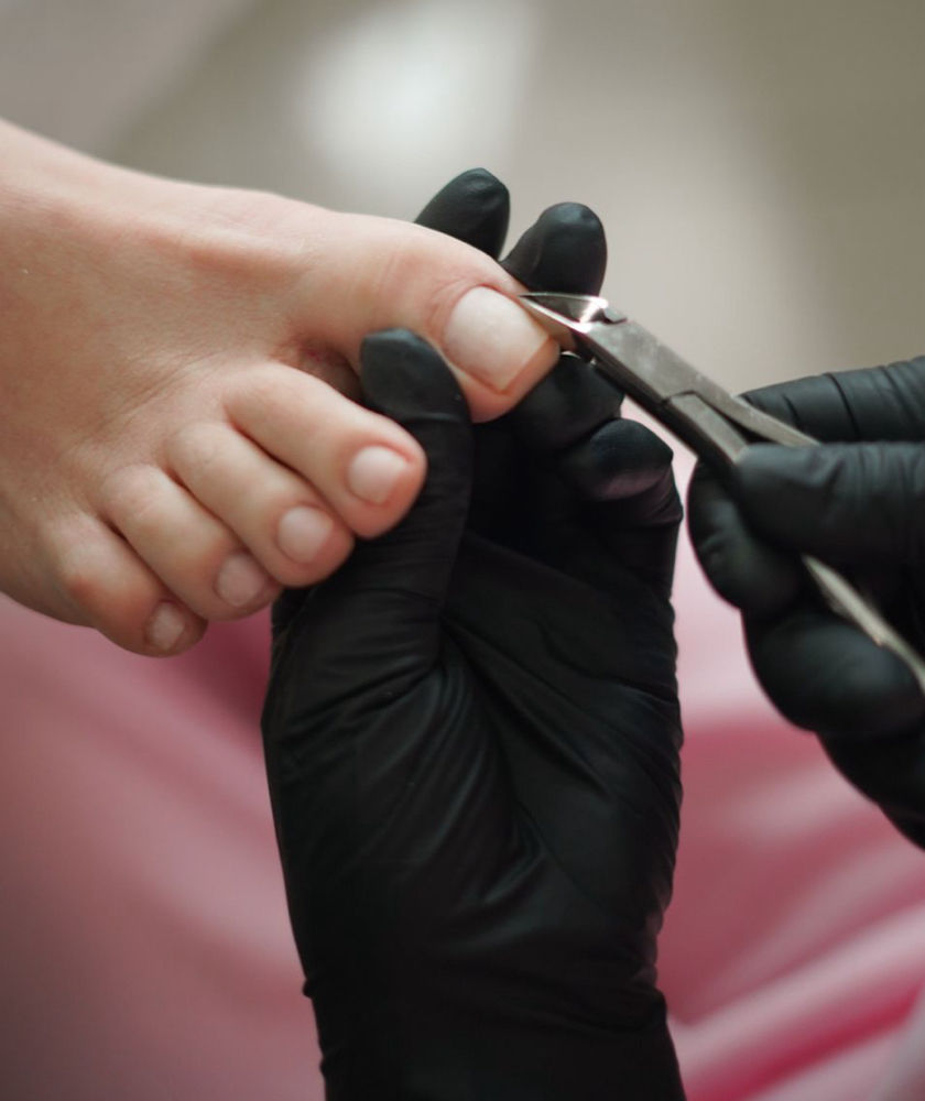 Pedicure