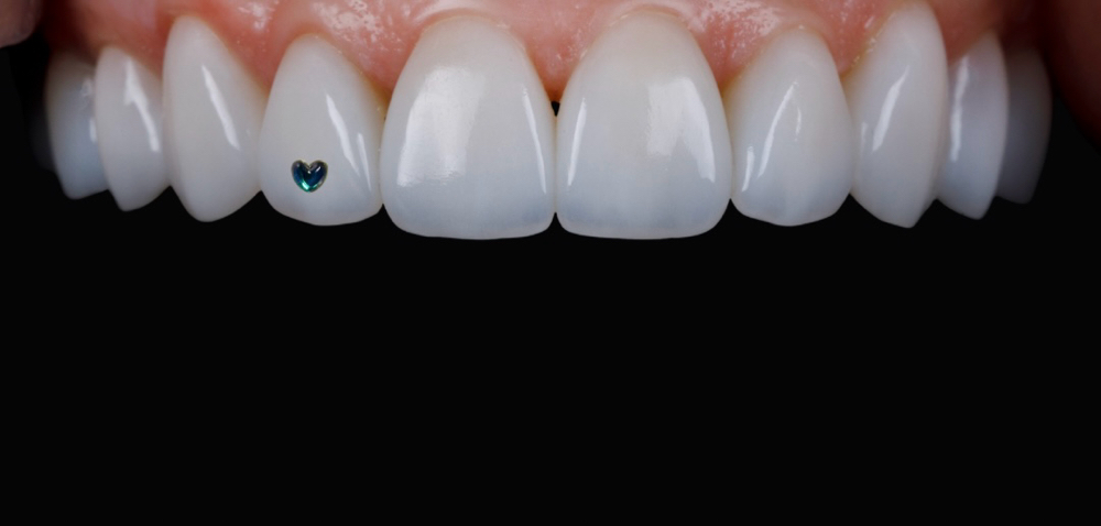 Micro Heart Crystal- Teal
