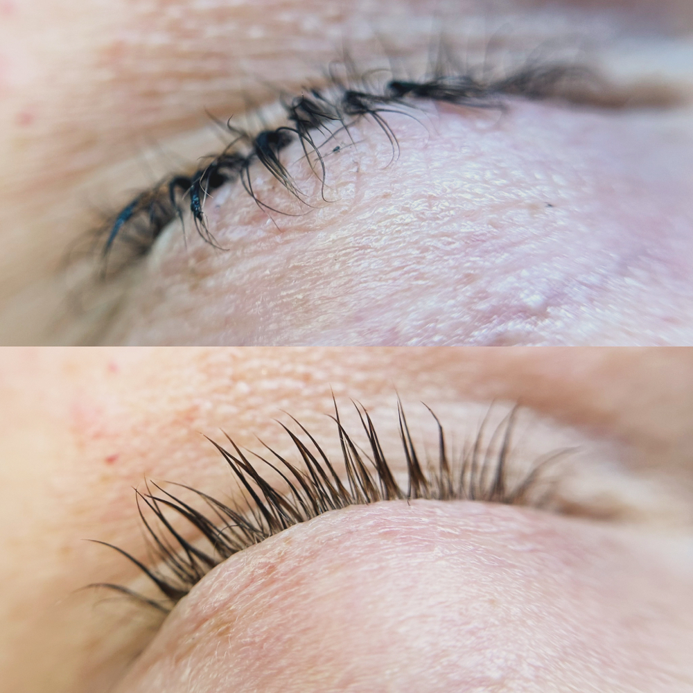 Lash Lift Reversal