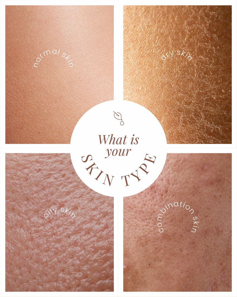 Skin/Chemical Peel Consultation at Bare Esthetics Medical Spa LLC in Idabel, OK