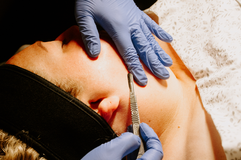 Dermaplane Facial