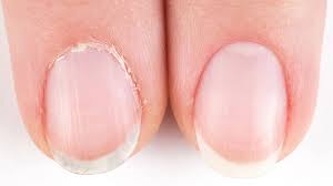 Cuticle trim
