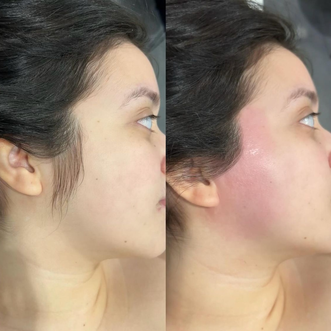 Waxing - Side-Burns at IMPRESS Aesthetic's, Beauty + Wellness Center PLLC in Lakewood, WA