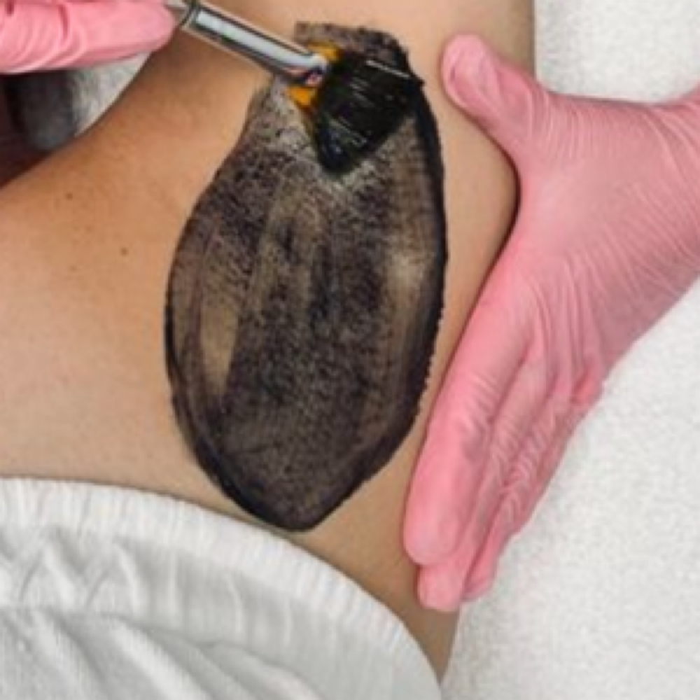 Underarm Facial at Esthetics With Michaela in Vidalia, LA