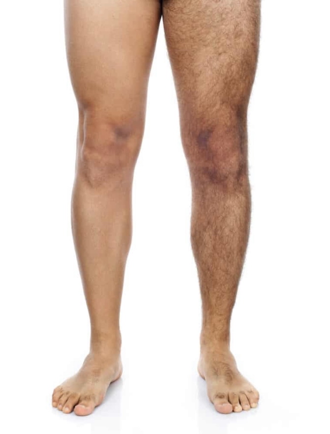 Lower Legs Wax Men