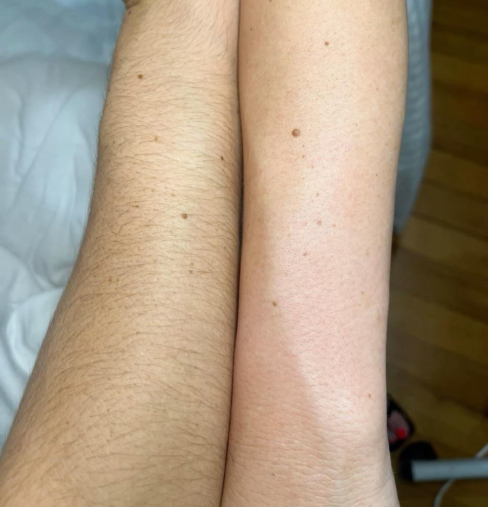 Half Arm Wax
