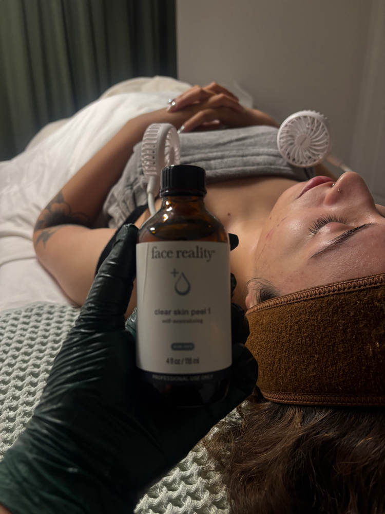 Face Reality Acne Treatment