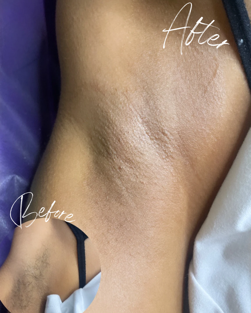 Underarm Wax