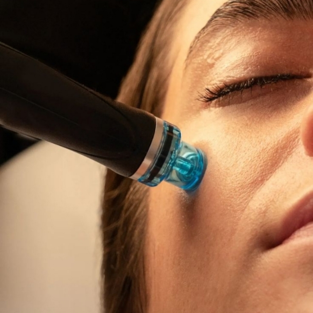 Clarifying Hydrafacial Treatment at Nourished Living Spa Skin and Scalp Therapy in Alpine, CA