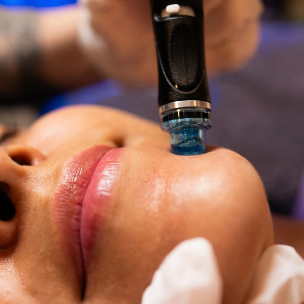 Hydrafacial at Yadis Nails & Spa Laser in Austin, TX