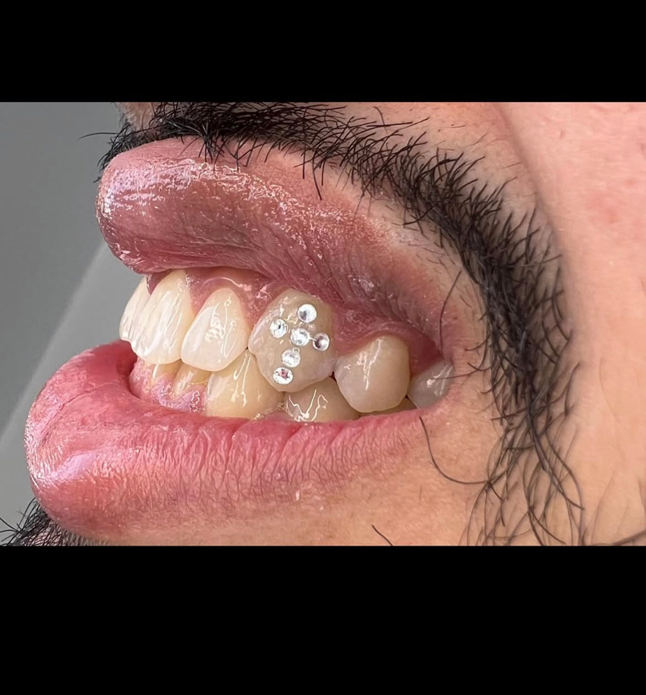 Cross Tooth Gem Set