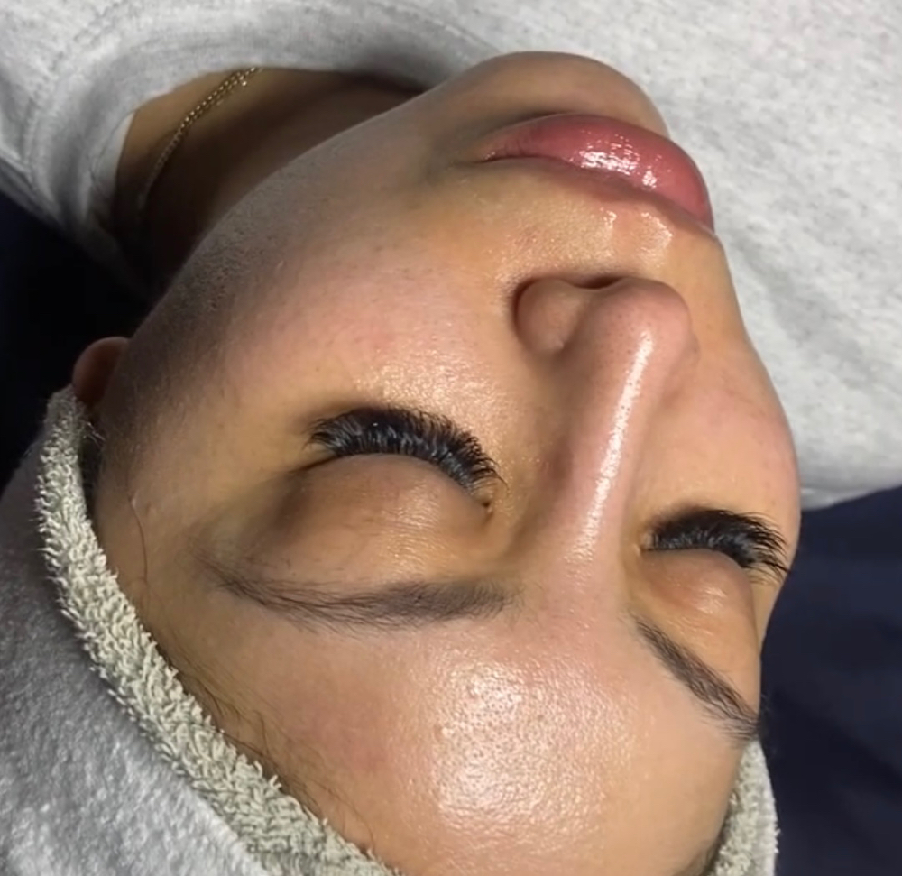 Custom Facial