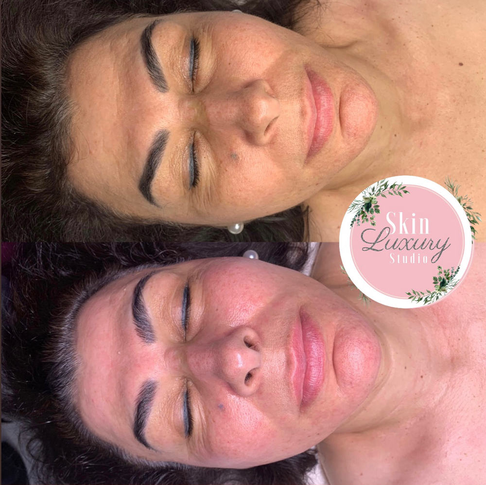Firming Peptide Facial