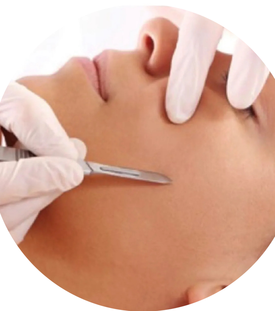 Dermaplane Only
