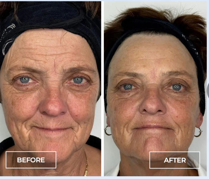 SWiCH Treatment