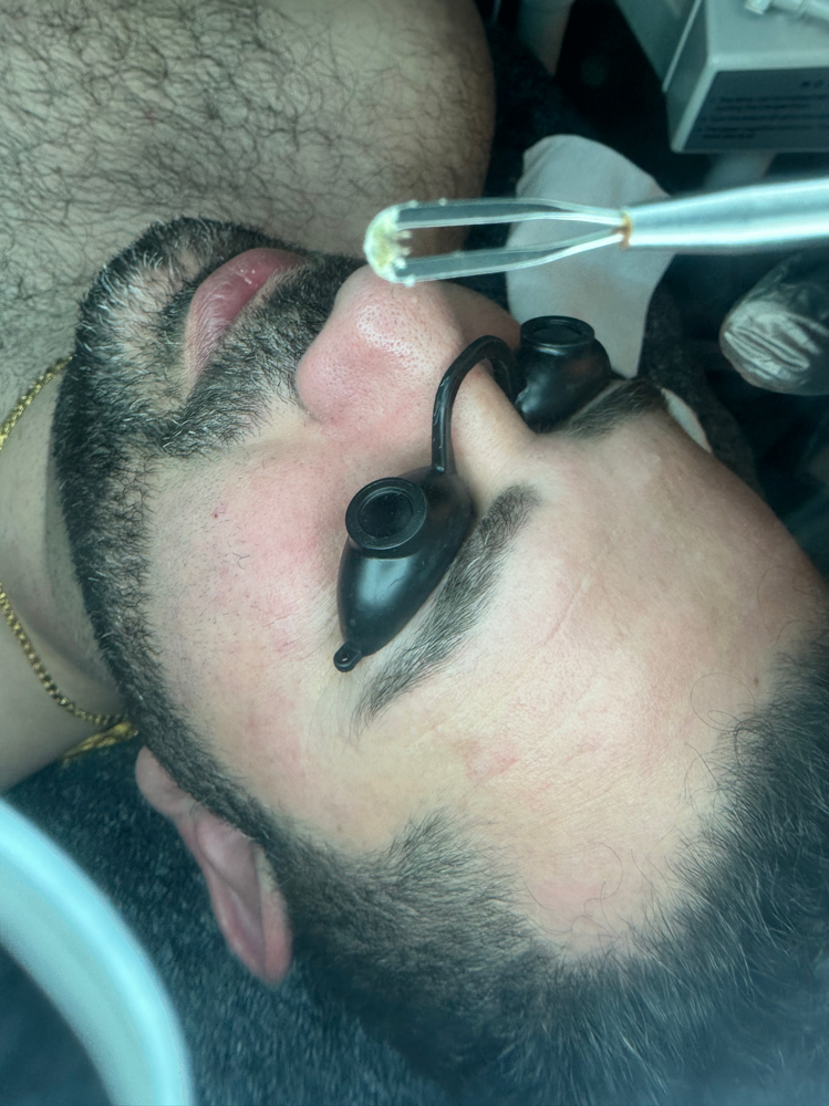 Extraction Treatment