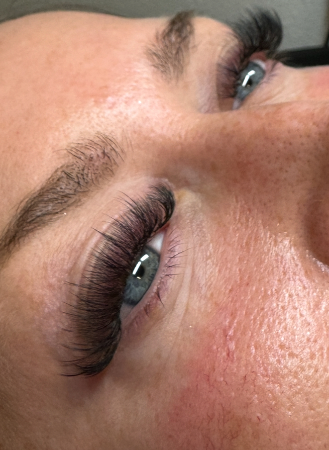 Hybrid Refill