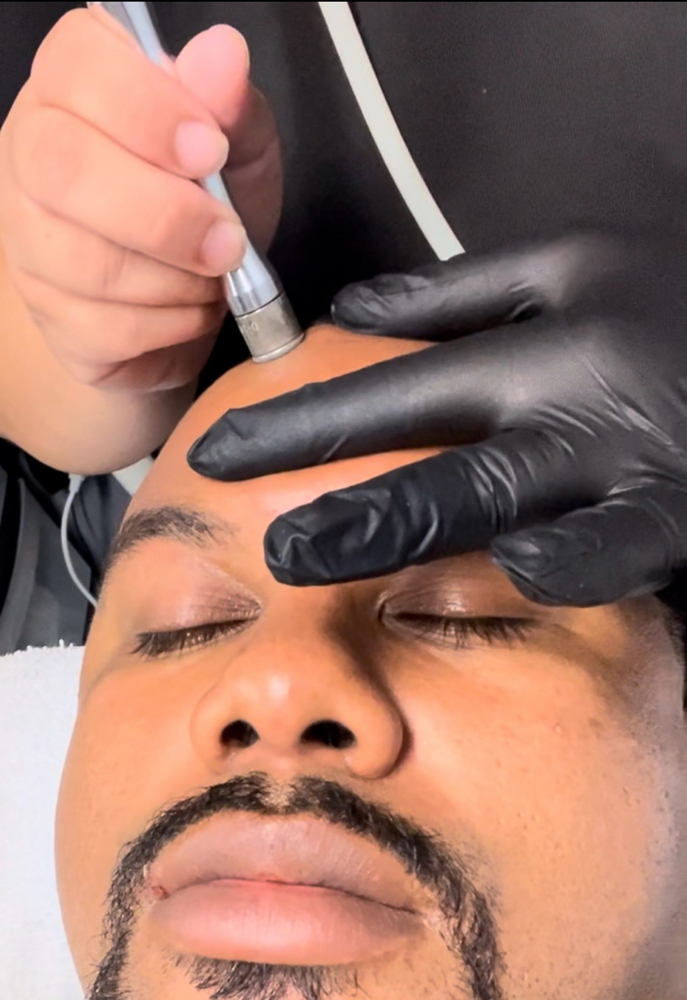 Microdermabrasion Facial