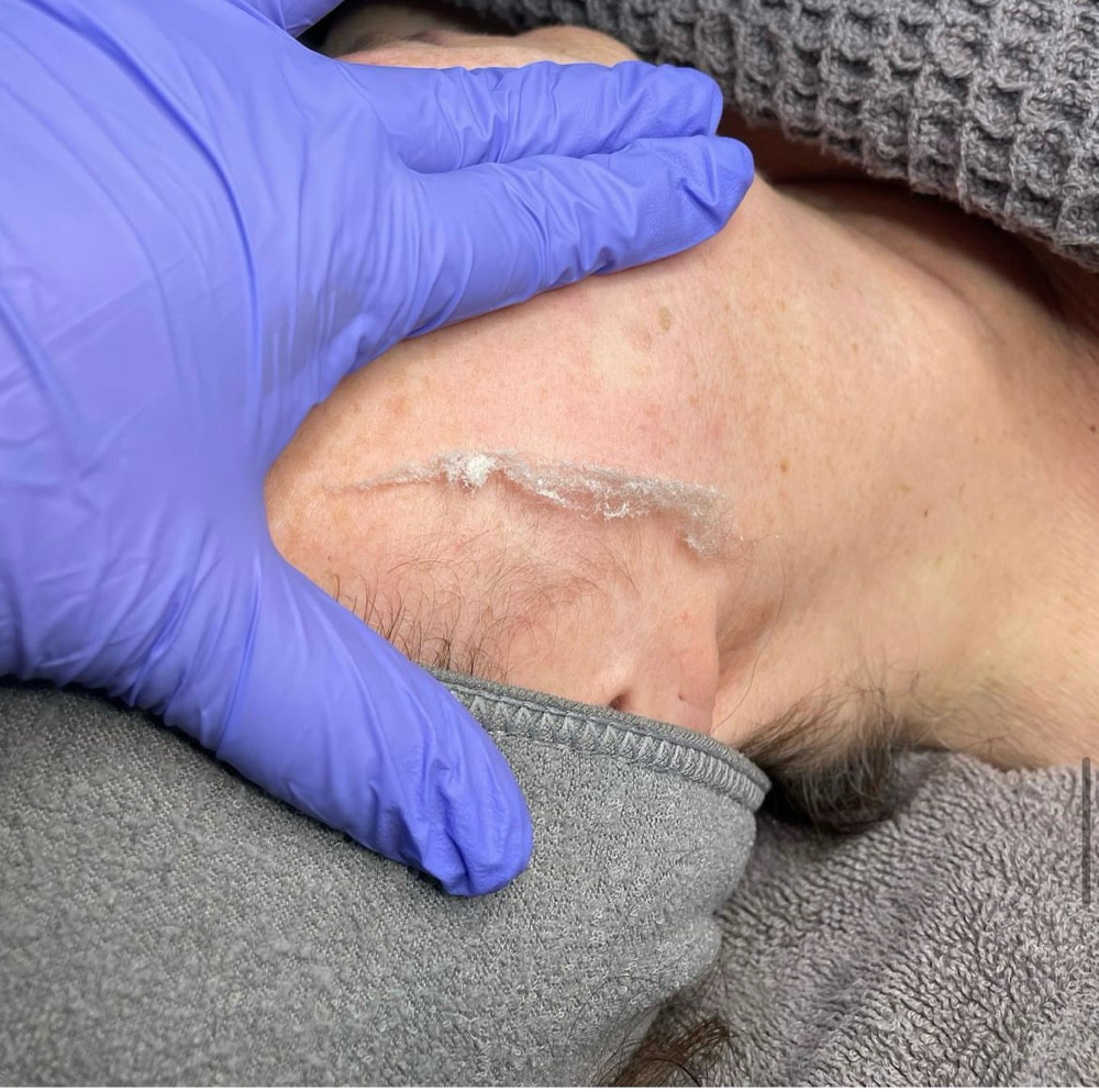 Dermaplanning Signature Facial